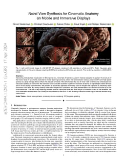 Application of 3D Gaussian Splatting for Cinematic Anatomy on Consumer
  Class Devices