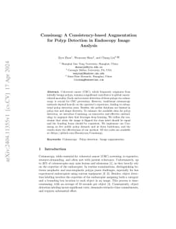 Consisaug: A Consistency-based Augmentation for Polyp Detection in
  Endoscopy Image Analysis
