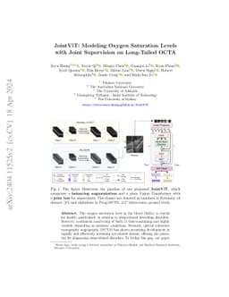 JointViT: Modeling Oxygen Saturation Levels with Joint Supervision on
  Long-Tailed OCTA
