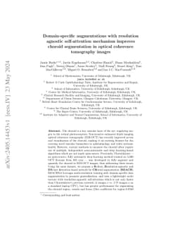 Domain-specific augmentations with resolution agnostic self-attention
  mechanism improves choroid segmentation in optical coherence tomography
  images