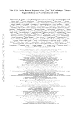 The 2024 Brain Tumor Segmentation (BraTS) Challenge: Glioma Segmentation
  on Post-treatment MRI