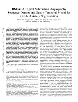 DSCA: A Digital Subtraction Angiography Sequence Dataset and Spatio-Temporal Model for Cerebral Artery Segmentation