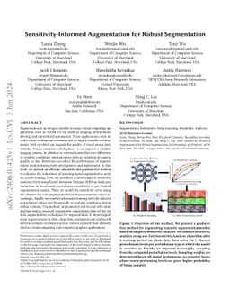 Sensitivity-Informed Augmentation for Robust Segmentation