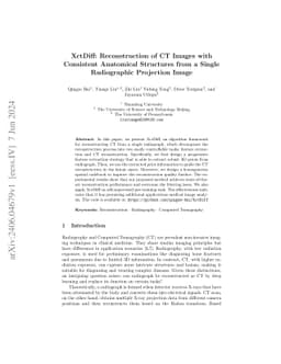 XctDiff: Reconstruction of CT Images with Consistent Anatomical
  Structures from a Single Radiographic Projection Image
