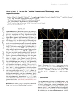 SR-CACO-2: A Dataset for Confocal Fluorescence Microscopy Image
  Super-Resolution