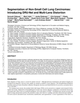 Segmentation of Non-Small Cell Lung Carcinomas: Introducing DRU-Net and
  Multi-Lens Distortion