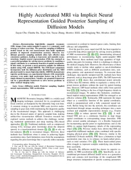 Highly Accelerated MRI via Implicit Neural Representation Guided
  Posterior Sampling of Diffusion Models