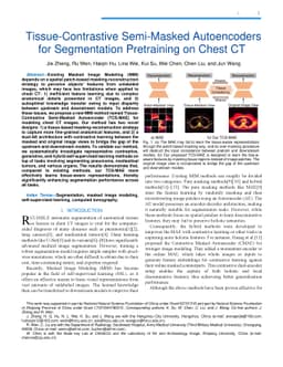 Tissue-Contrastive Semi-Masked Autoencoders for Segmentation Pretraining
  on Chest CT