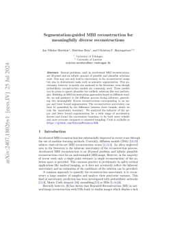 Segmentation-guided MRI reconstruction for meaningfully diverse
  reconstructions