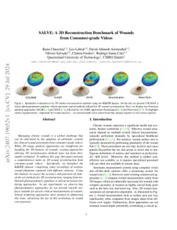 SALVE: A 3D Reconstruction Benchmark of Wounds from Consumer-grade
  Videos