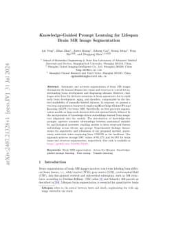 Knowledge-Guided Prompt Learning for Lifespan Brain MR Image
  Segmentation