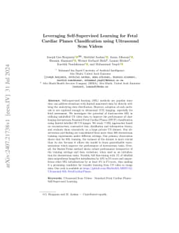Leveraging Self-Supervised Learning for Fetal Cardiac Planes
  Classification using Ultrasound Scan Videos
