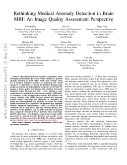Rethinking Medical Anomaly Detection in Brain MRI: An Image Quality
  Assessment Perspective