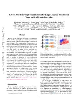R2GenCSR: Retrieving Context Samples for Large Language Model based
  X-ray Medical Report Generation