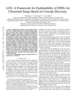 LCE: A Framework for Explainability of DNNs for Ultrasound Image Based
  on Concept Discovery