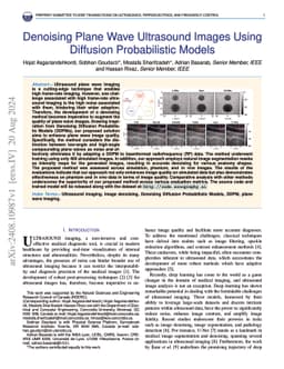 Denoising Plane Wave Ultrasound Images Using Diffusion Probabilistic
  Models
