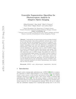 Generalist Segmentation Algorithm for Photoreceptors Analysis in
  Adaptive Optics Imaging