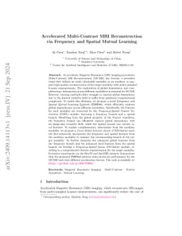 Accelerated Multi-Contrast MRI Reconstruction via Frequency and Spatial
  Mutual Learning