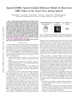 Speech2rtMRI: Speech-Guided Diffusion Model for Real-time MRI Video of
  the Vocal Tract during Speech