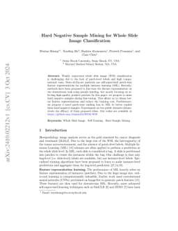 Hard Negative Sample Mining for Whole Slide Image Classification