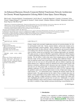 An Enhanced Harmonic Densely Connected Hybrid Transformer Network
  Architecture for Chronic Wound Segmentation Utilising Multi-Colour Space
  Tensor Merging
