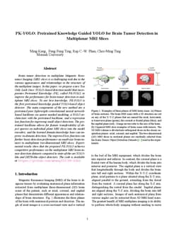 PK-YOLO: Pretrained Knowledge Guided YOLO for Brain Tumor Detection in Multiplanar MRI Slices