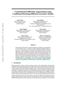 Counterfactual MRI Data Augmentation using Conditional Denoising
  Diffusion Generative Models