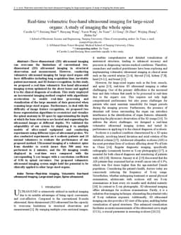 Real-time volumetric free-hand ultrasound imaging for large-sized
  organs: A study of imaging the whole spine