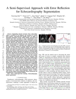 A Semi-Supervised Approach with Error Reflection for Echocardiography
  Segmentation