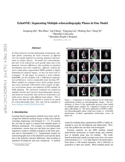 EchoONE: Segmenting Multiple echocardiography Planes in One Model