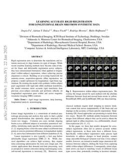 Learning accurate rigid registration for longitudinal brain MRI from synthetic data