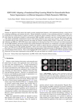 GBT-SAM: Adapting a Foundational Deep Learning Model for Generalizable Brain Tumor Segmentation via Efficient Integration of Multi-Parametric MRI Data