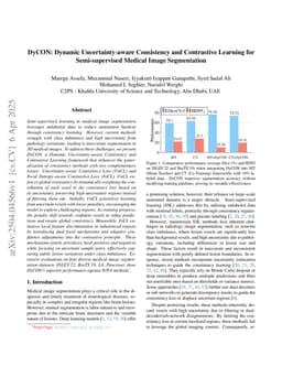 DyCON: Dynamic Uncertainty-aware Consistency and Contrastive Learning for Semi-supervised Medical Image Segmentation