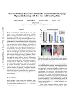 RadZero: Similarity-Based Cross-Attention for Explainable Vision-Language Alignment in Radiology with Zero-Shot Multi-Task Capability