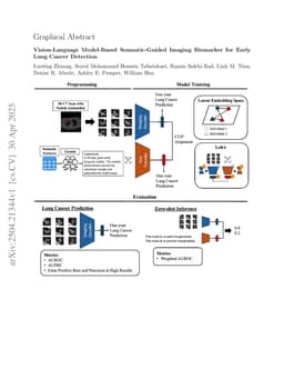 Vision-Language Model-Based Semantic-Guided Imaging Biomarker for Early Lung Cancer Detection