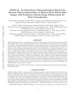 ADNP-15: An Open-Source Histopathological Dataset for Neuritic Plaque Segmentation in Human Brain Whole Slide Images with Frequency Domain Image Enhancement for Stain Normalization
