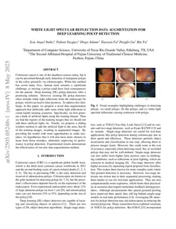 White Light Specular Reflection Data Augmentation for Deep Learning Polyp Detection