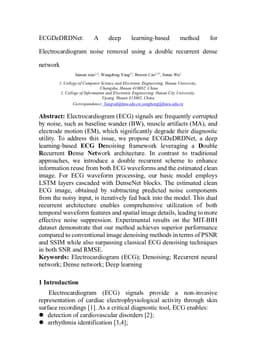 ECGDeDRDNet: A deep learning-based method for Electrocardiogram noise removal using a double recurrent dense network