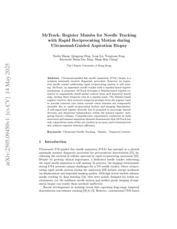 MrTrack: Register Mamba for Needle Tracking with Rapid Reciprocating Motion during Ultrasound-Guided Aspiration Biopsy