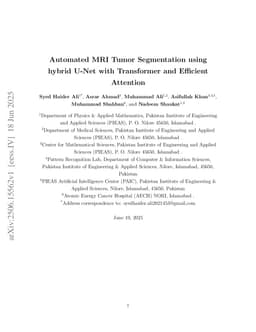 Automated MRI Tumor Segmentation using hybrid U-Net with Transformer and Efficient Attention