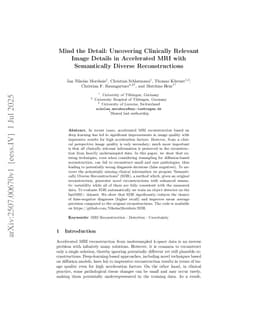 Mind the Detail: Uncovering Clinically Relevant Image Details in Accelerated MRI with Semantically Diverse Reconstructions